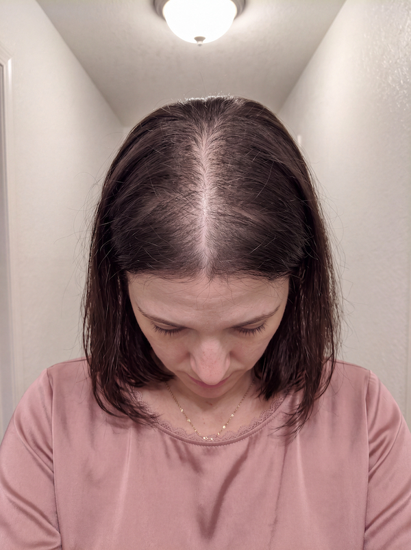 Before